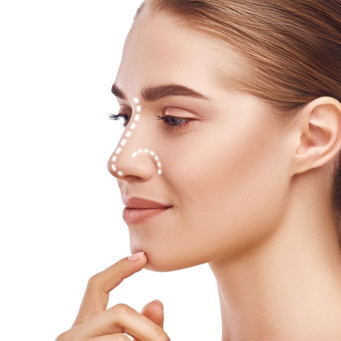 Non-Surgical Nose Job